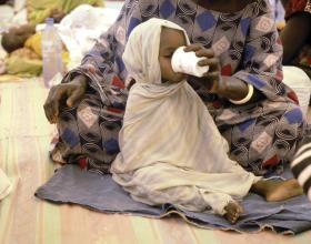 A malnourished and dehydrated infant is cared for at "Terre des Hommes" in Nouakchott, Mauritania.